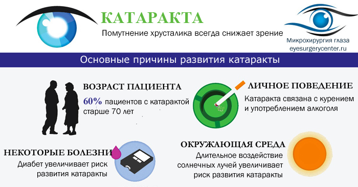 Причины возникновения катаракты