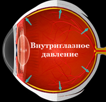 Глаукома. Что это такое?